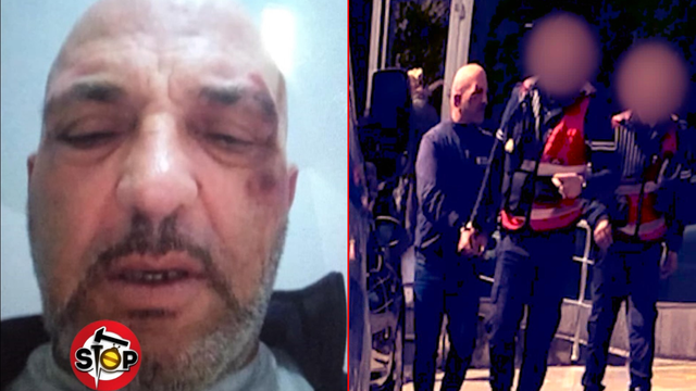 Denoncimi/ Policia e Lezhës arreston dhe keqtrajton qytetarin, i nxin sytë